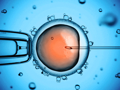 Inseminazione artificiale