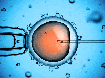 Inseminazione artificiale