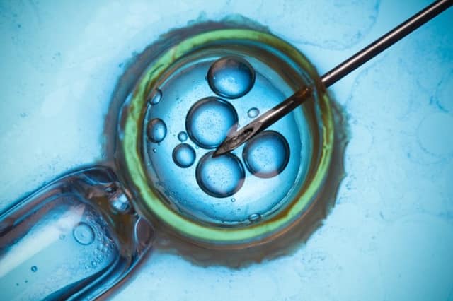 Ricerca al microscopio da laboratorio o concetto macro IVF