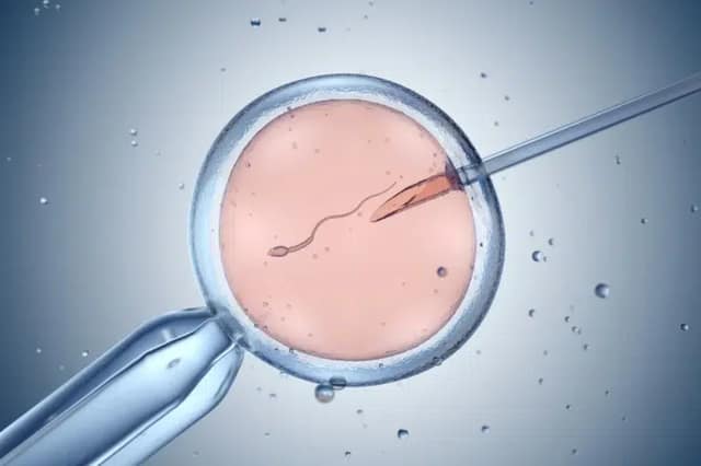 Inseminazione artificiale o fecondazione in vitro
