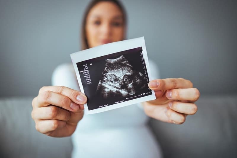 felice giovane donna incinta in possesso di ultrasuoni